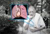 Un cheag de sânge în artera pulmonară: nu pierde primele semne