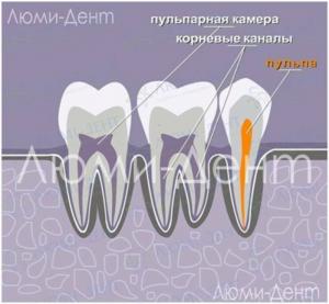 Cum să găsiți și să tratați canalele dentare în Lumident