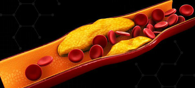 Colesterolul - cholesterin