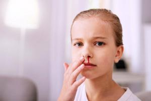 Cum să opriți sângerarea nasului unui copil: sfatul medicului pediatru