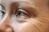 Cum de a preveni aparitia ridurilor din jurul ochilor