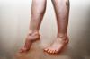 Încălcarea fluxului sanguin la nivelul picioarelor: cauze, simptome