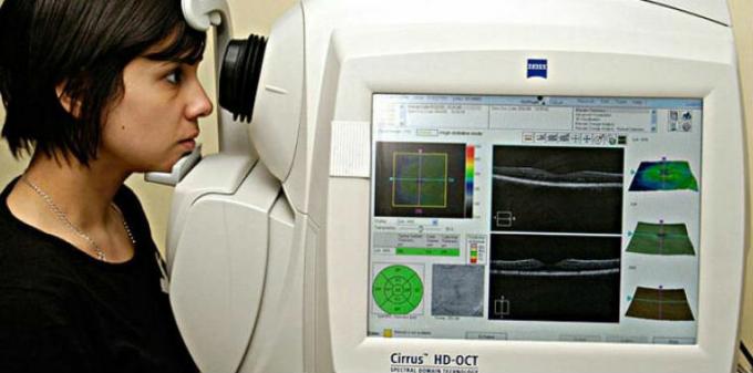 tomografie optica coerenta angiografie