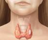 Nodurile din glandei tiroide: este posibil să nu poți?