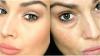 5 rețete vechi pentru a ajuta la a face proaspăt aspect și pielea elastică din jurul ochilor și tineri