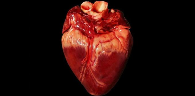Bolnav inima - inima bolnavă