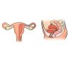 Ce se întâmplă cu uter înainte și după naștere: ceea ce are nevoie de studiu