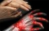 Simptomele și cauzele artritei reumatoide ca avertiza