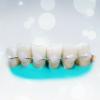 Populare dinți atele: cât de mult în mod eficient?