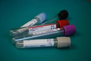Fapte de top despre grupuri de sânge care părinții trebuie să știe
