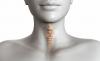 Semne de defecțiuni tiroidiene, pentru care noi nu acorde atenție