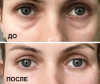 Un ieftine masca 40 de ruble corecție caneluri nazolacrimal: rezultatul după prima aplicare. Cosmetician nu mai este necesară