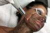Laser peeling de carbon: orice problemă a pielii aduce la idealul