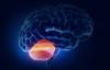 O tumoare cerebelului: simptome de patologie