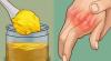 Cum sa scapi de durere la nivelul articulațiilor mâinilor