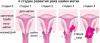 7 semne de cancer de col uterin, care de multe ori femeile ignoră