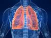 Fumătorii: cum de a curăța bronhii, plămâni?